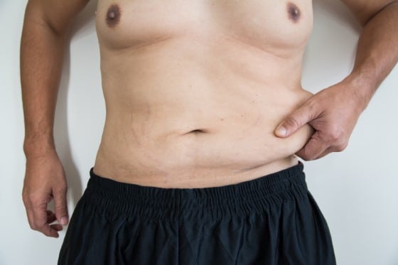 male tummy tuck coffs harbour